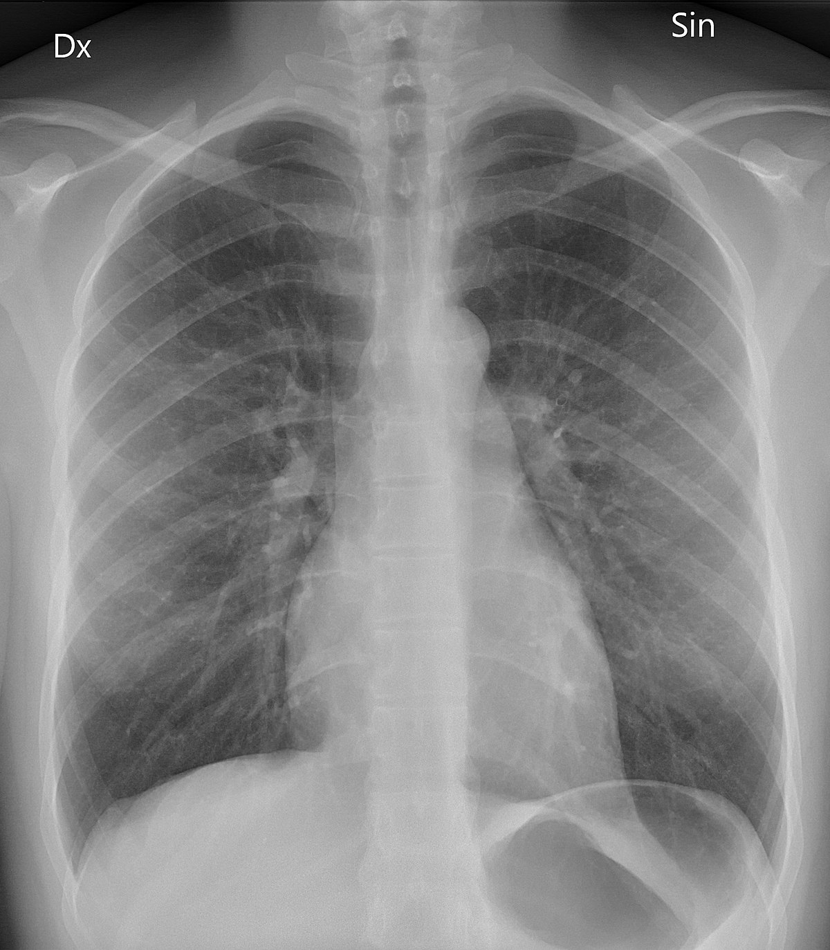 X-Ray Görüntüsü Projesi
